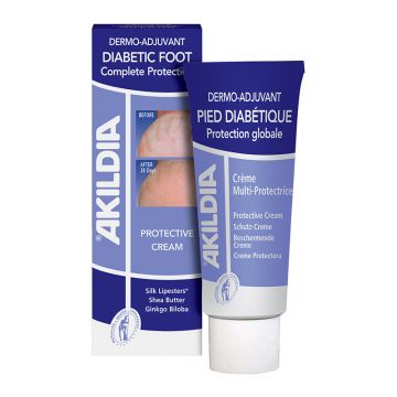 Akildia crema pentru piciorul diabeticului Asepta 75 ml